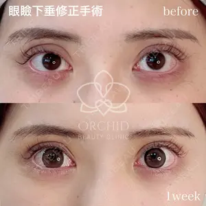 オーキッド美容クリニック東京御徒町 西浦　蘭子医師の症例