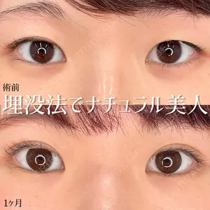 東京シンデレラ美容外科 新宿院 髙田 怜医師の症例