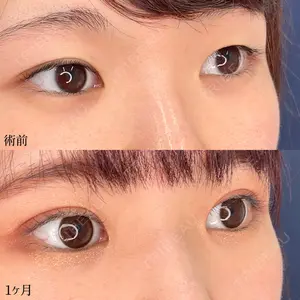 東京シンデレラ美容外科 新宿院 髙田 怜医師の症例