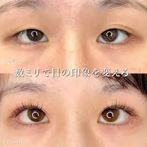 東京シンデレラ美容外科 池袋院 小出 真哉医師の症例