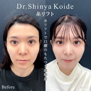 東京シンデレラ美容外科 池袋院 小出 真哉医師の症例