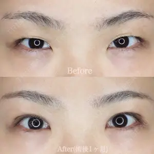ハナビューティークリニック 厚田 幸子医師の症例