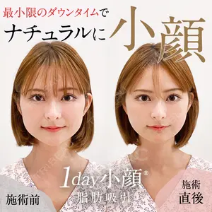 A CLINIC（エークリニック） 仙台院 中村 光宏医師の症例