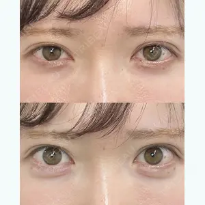 ルラ美容クリニック 大阪院 平田 一記医師の症例