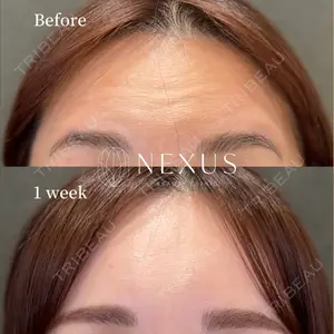 NEXUS CLINIC 渡辺　佳奈医師の症例