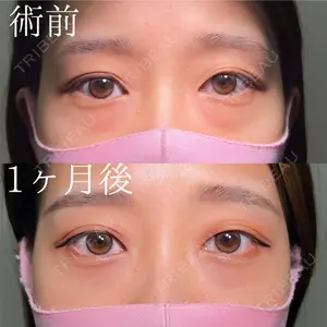 HAAB×DREAM BEAUTY CLINIC 大阪梅田院 鈴木 馨斗医師の症例