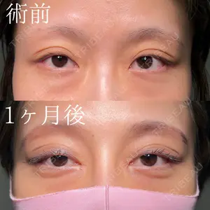 HAAB×DREAM BEAUTY CLINIC 大阪梅田院 鈴木 馨斗医師の症例
