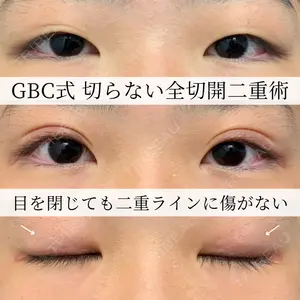 グローバルビューティークリニック 大阪院 理事長　杉崎　裕斗医師の症例