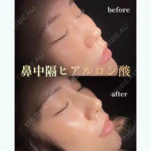 HAAB×DREAM BEAUTY CLINIC 東京本院 佐野 圭医師の症例