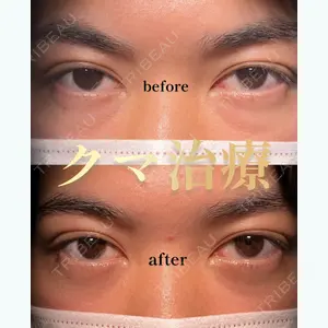 HAAB×DREAM BEAUTY CLINIC 東京本院 佐野 圭医師の症例