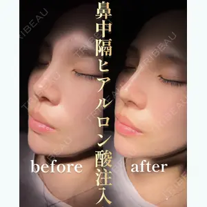 HAAB×DREAM BEAUTY CLINIC 東京本院 佐野 圭医師の症例