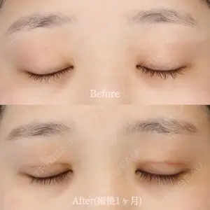 ハナビューティークリニック 厚田 幸子医師の症例