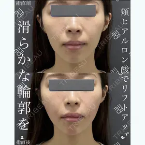 EMMO FACE CLINIC 大宮院 廣松 直樹医師の症例
