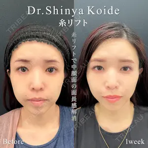東京シンデレラ美容外科 池袋院 小出 真哉医師の症例