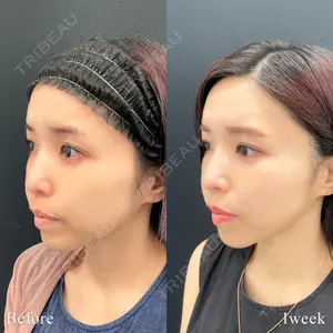 東京シンデレラ美容外科 池袋院 小出 真哉医師の症例