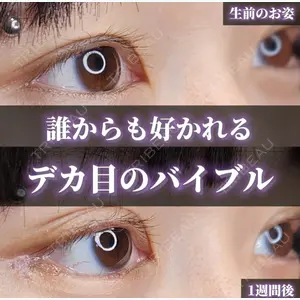 Tokyo Tensei Clinic 沖津 勇気医師の症例
