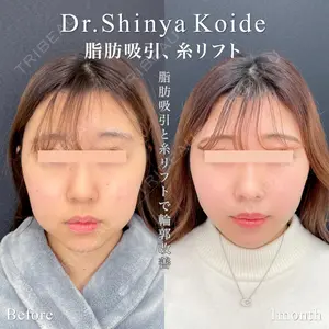 東京シンデレラ美容外科 池袋院 小出 真哉医師の症例