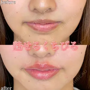 ルラ美容クリニック 名古屋院 右京 大季医師の症例