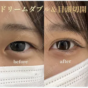 HAAB×DREAM BEAUTY CLINIC 東京本院 田中 優太医師の症例