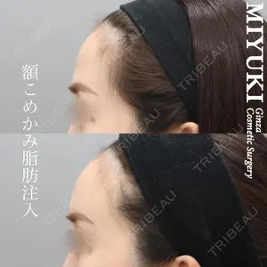 銀座みゆき通り美容外科 大阪梅田院の症例