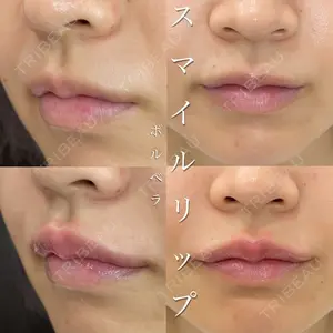 ルラ美容クリニック 高田馬場院 若佐 卓矢医師の症例