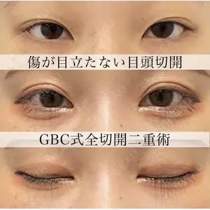 グローバルビューティークリニック 大阪院 理事長　杉崎　裕斗医師の症例