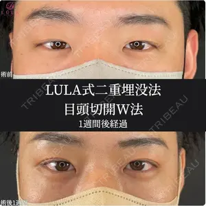 ルラ美容クリニック 福岡院 藤川 一朗医師の症例