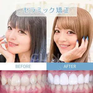 A CLINIC（エークリニック） デンタル 銀座 古居 憲医師の症例
