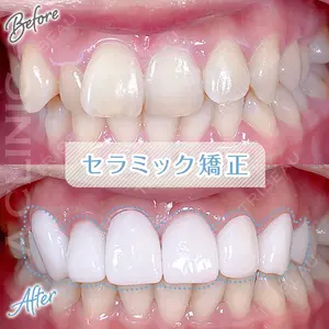 A CLINIC（エークリニック） デンタル 銀座 古居 憲医師の症例