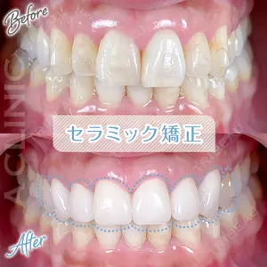 A CLINIC（エークリニック） デンタル 銀座 古居 憲医師の症例