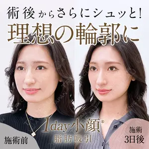A CLINIC（エークリニック） 福岡院 片桐 大佑医師の症例