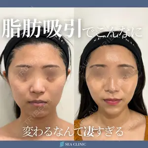 SEA CLINIC（シークリニック） 沼澤　茂医師の症例