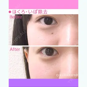 東京形成美容外科 船橋院 弓削田　浩主医師の症例