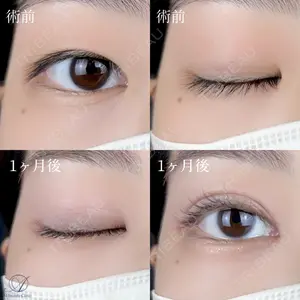AI Beauty Clinic （エーアイ美容クリニック） 尾崎 宥文医師の症例