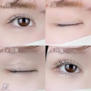 AI Beauty Clinic （エーアイ美容クリニック） 尾崎 宥文医師の症例