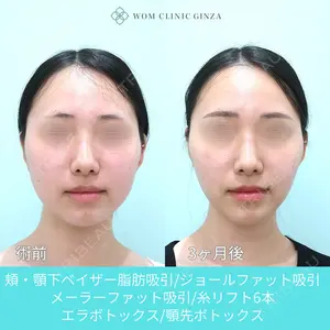 WOM CLINIC GINZA （ワム クリニック ギンザ） 深堀 純也医師の症例