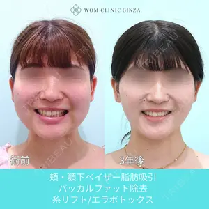 WOM CLINIC GINZA （ワム クリニック ギンザ） 深堀 純也医師の症例