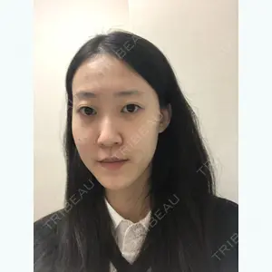 TL美容整形外科 顔面輪郭・目・鼻センター キム・ジミョン医師の症例