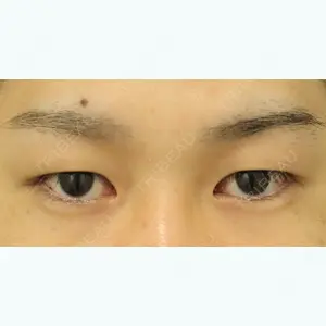 東京イセアクリニック 吉種 克之医師の症例