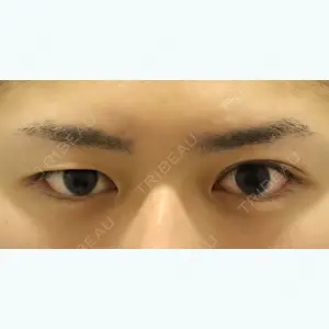 東京イセアクリニック 吉種 克之医師の症例