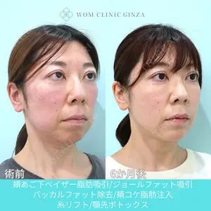WOM CLINIC GINZA （ワム クリニック ギンザ） 深堀 純也医師の症例