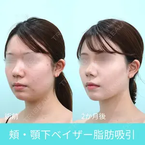WOM CLINIC GINZA （ワム クリニック ギンザ） 荒井 香織医師の症例