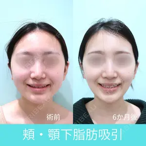 WOM CLINIC GINZA （ワム クリニック ギンザ） 深堀 純也医師の症例