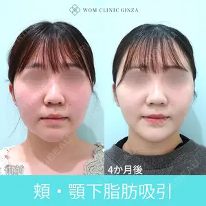 WOM CLINIC GINZA （ワム クリニック ギンザ） 深堀 純也医師の症例