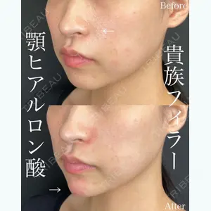 ルラ美容クリニック 大阪院 平田 一記医師の症例