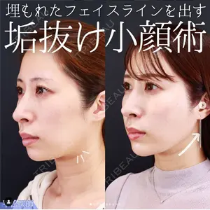 大阪TAクリニック 平松 敦医師の症例