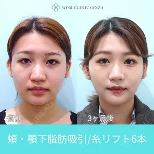 WOM CLINIC GINZA （ワム クリニック ギンザ） 深堀 純也医師の症例