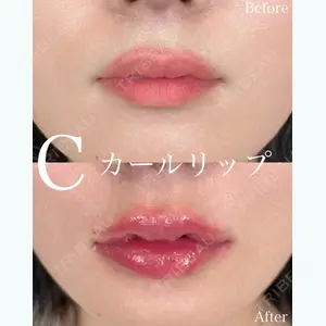 ルラ美容クリニック 大阪院 平田 一記医師の症例