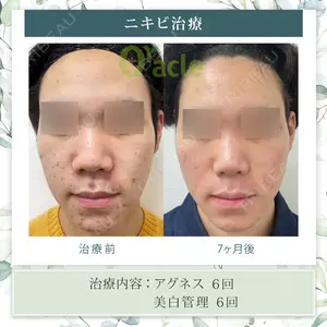 オラクル美容皮膚科 東京新宿院の症例