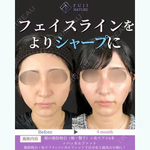 藤・ナチュレ美容クリニック 銀座院 藍 嵐医師の症例